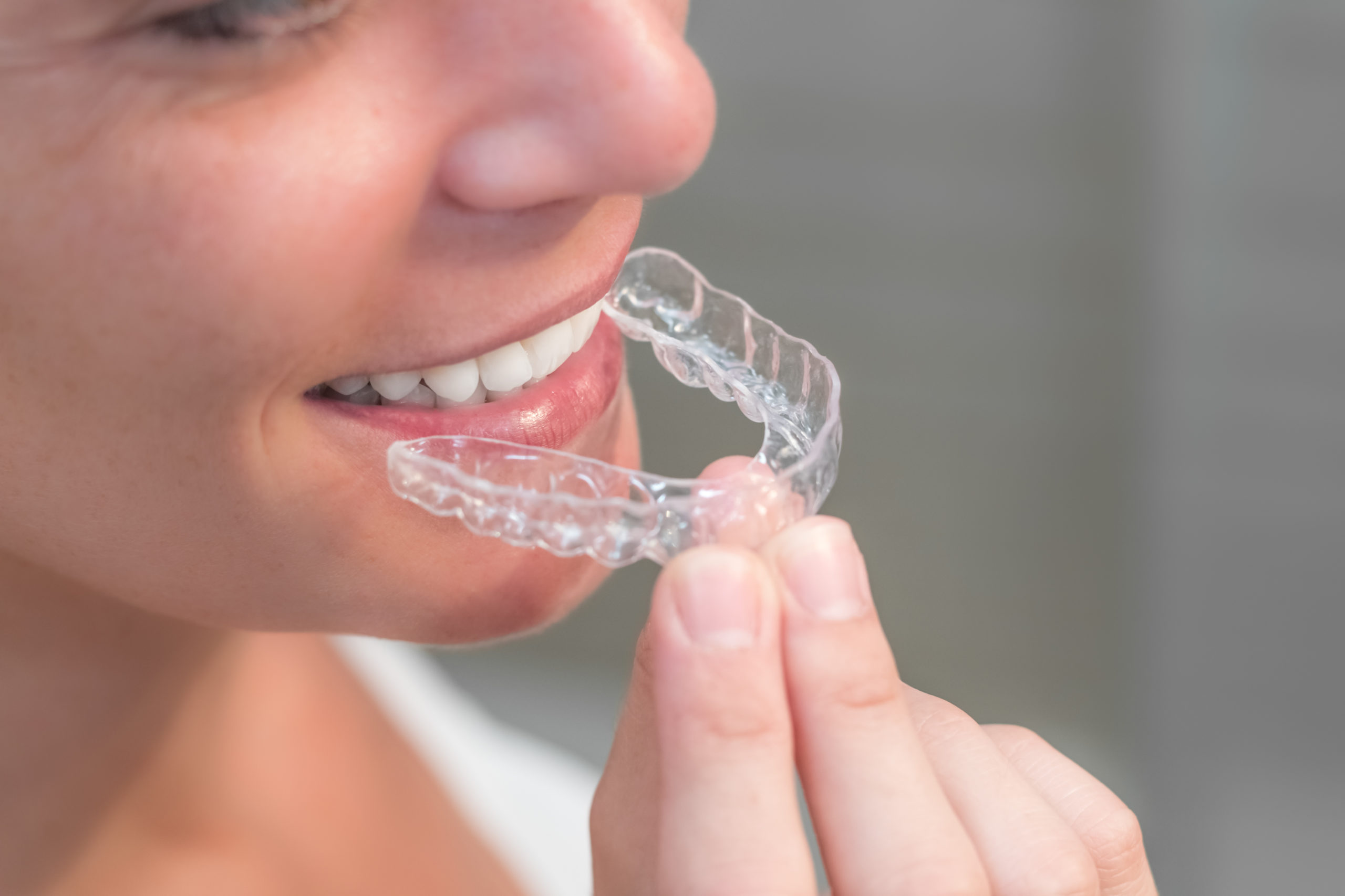 How effective and safe are teeth whitening products