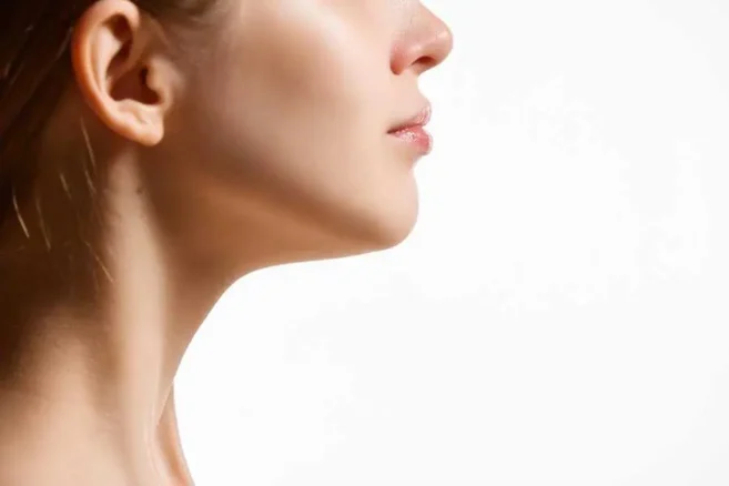 kybella-vs-liposuction by Wilson Aesthetics Beauty + Wellness in Arizona