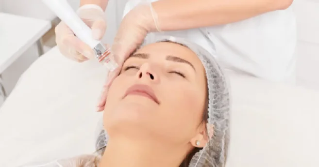 Skin Tightening by Wilson Aesthetics Beauty + Wellness in Arizona