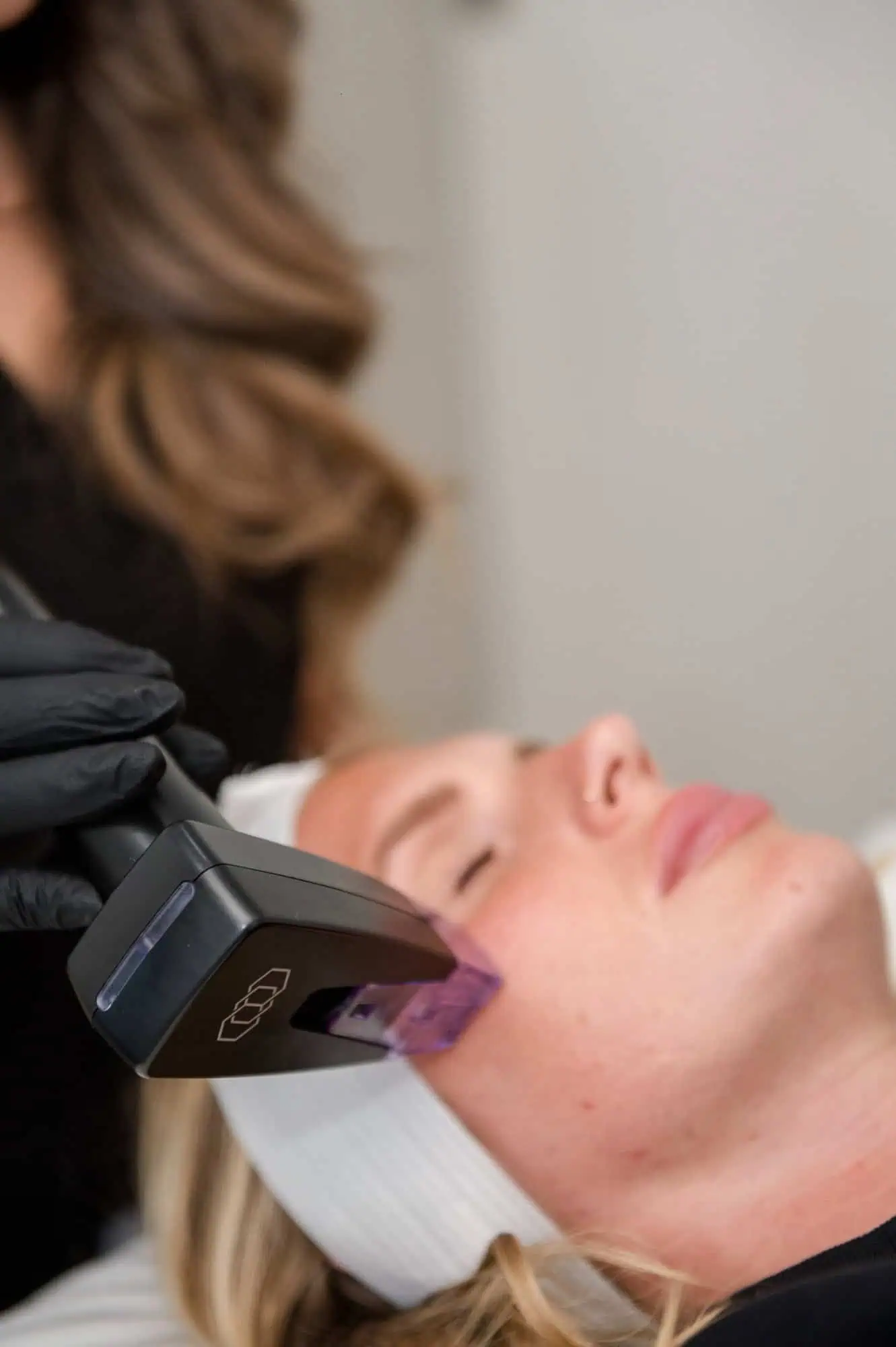 laser treatments by wilson aesthetic in Prescott Valley,AZ