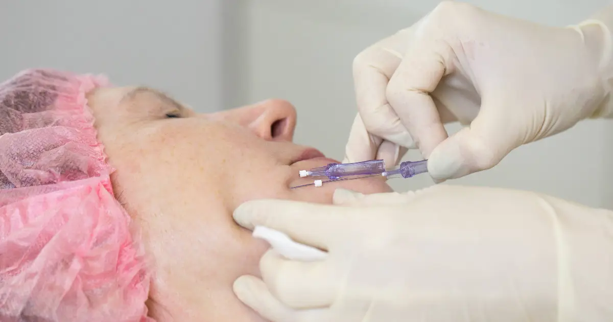 PDO Thread Lifts in Prescott Valley, AZ