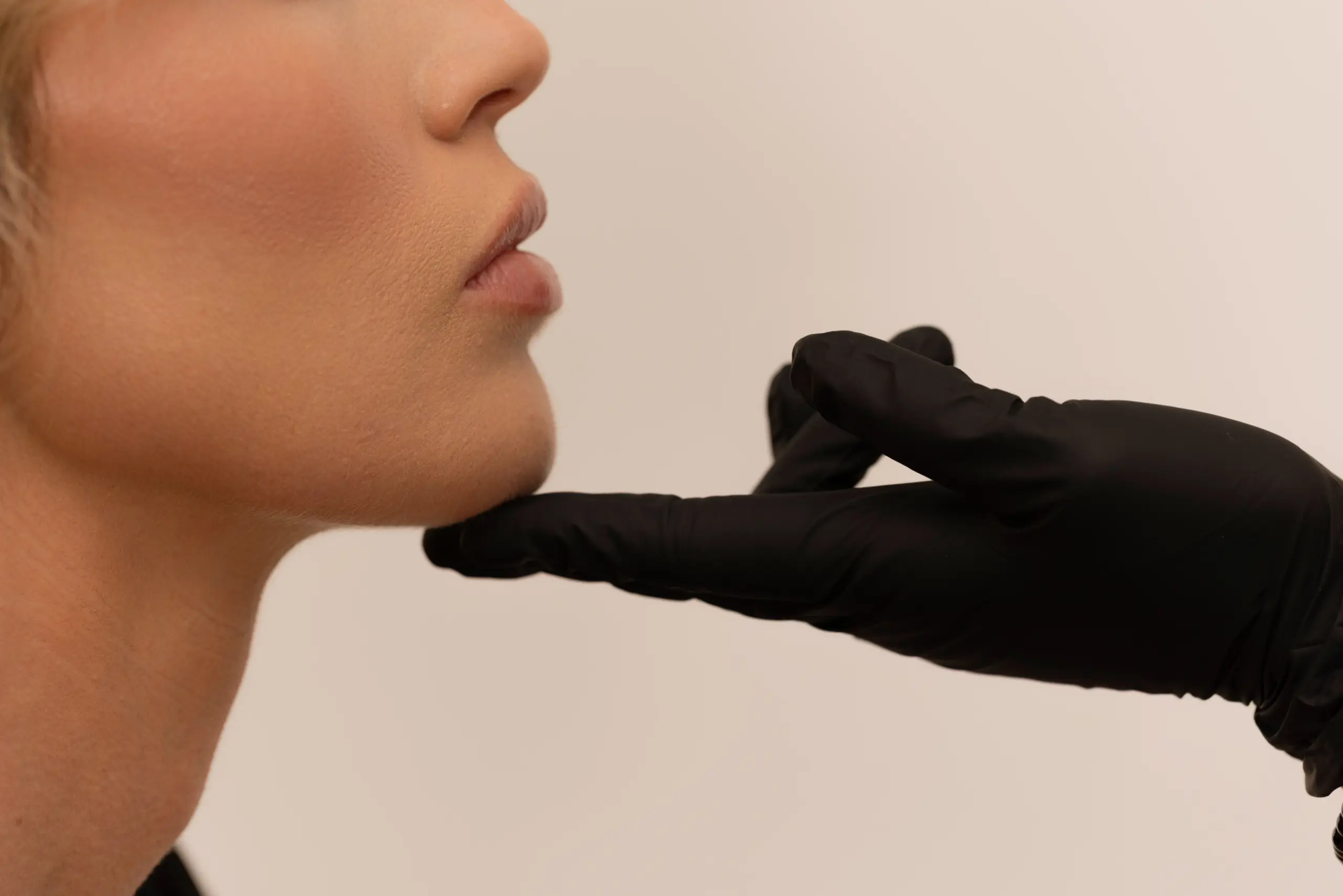 Forma Skin Tightening