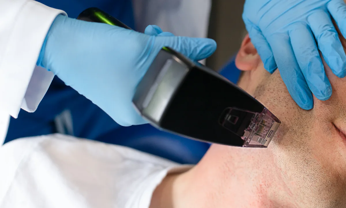 Morpheus8 for Skin Tightening Without Surgery