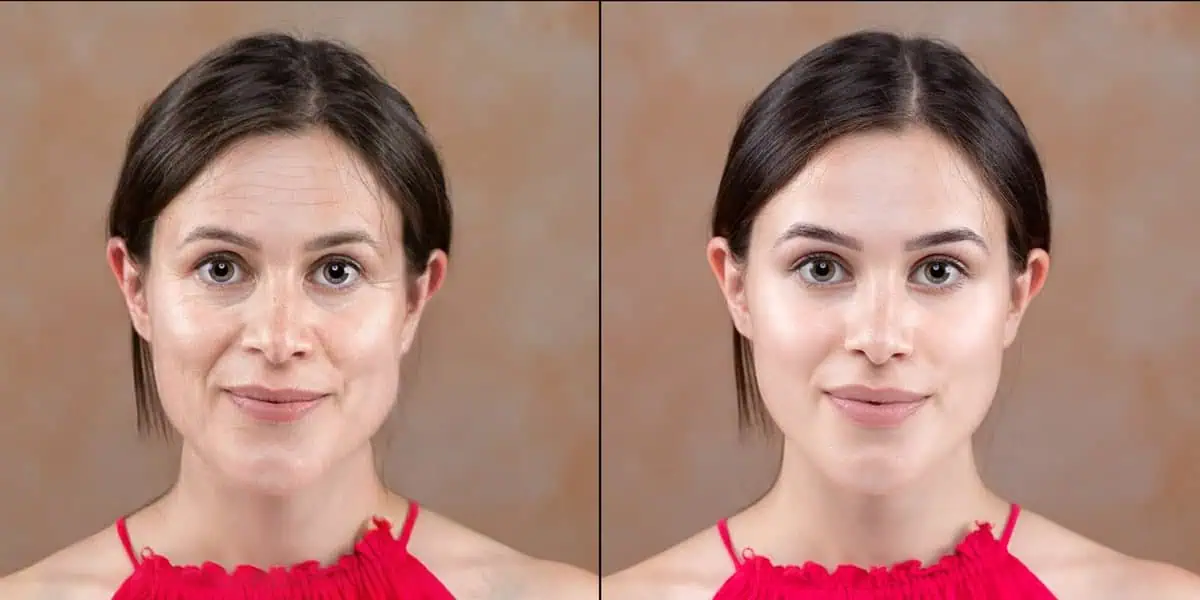 Everything You Need To Know About SmartXide Tetra CO2 & CoolPeel